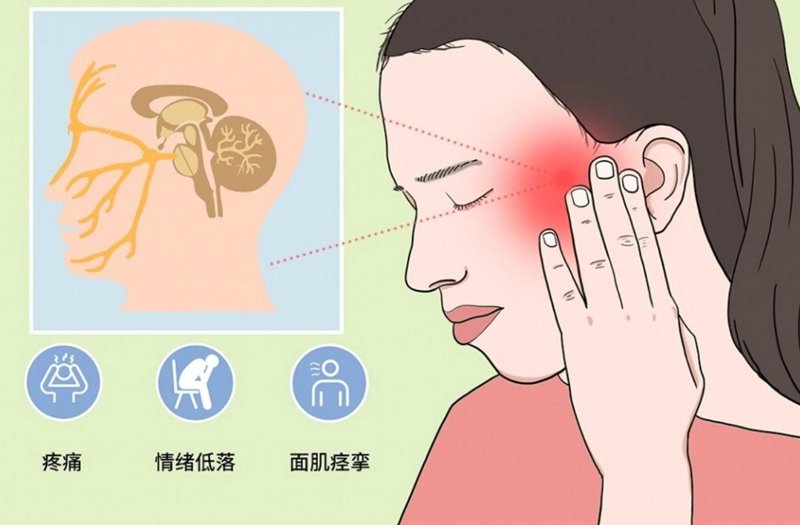 面肌痉挛