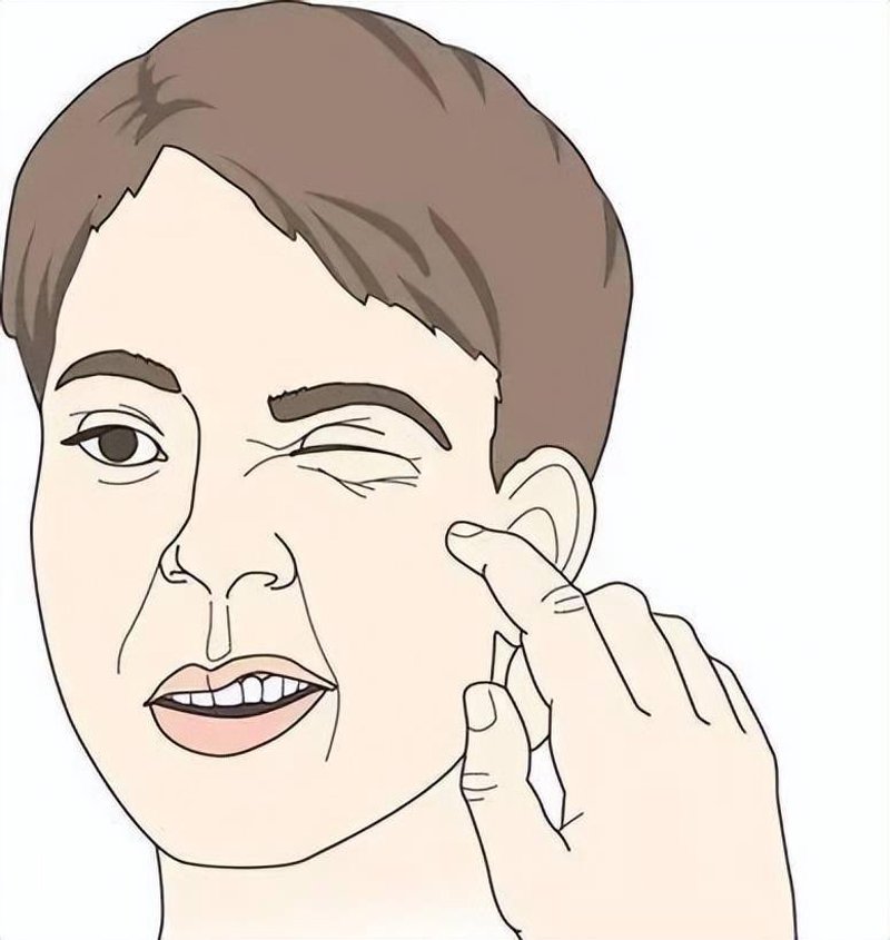 面神经麻痹，一个让人措手不及的疾病，许多人在面对它时往往不知所措。今天，我们就来聊聊这个话题，通过具体案例来解析如何应对。